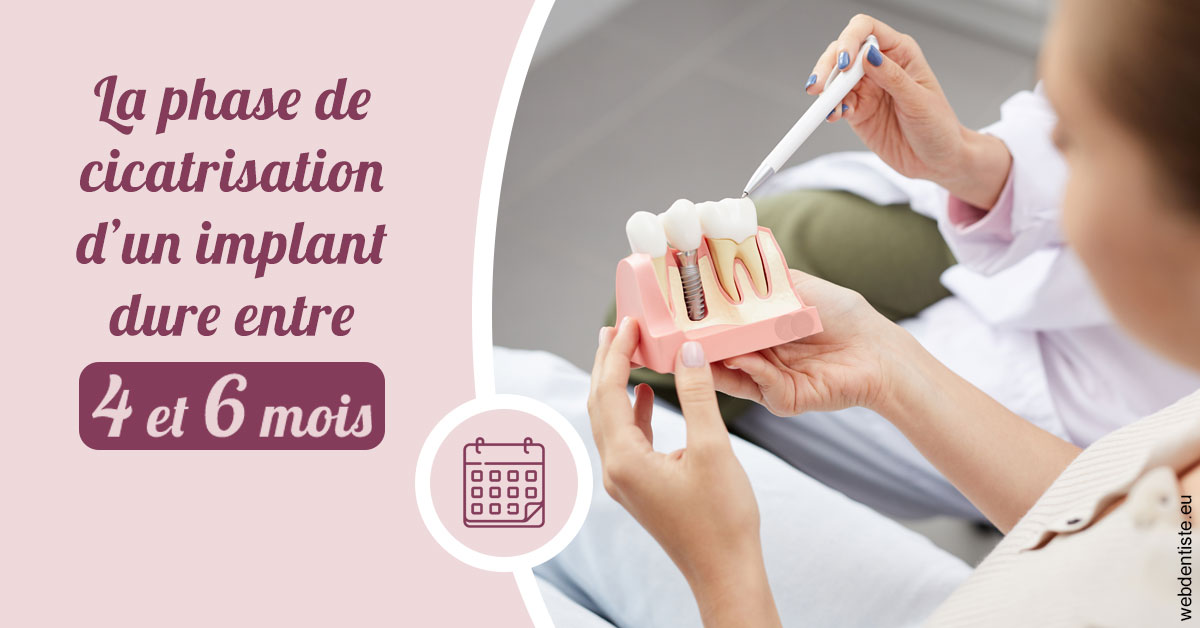 https://www.selarl-dentistes-le-canet.fr/Cicatrisation implant 2