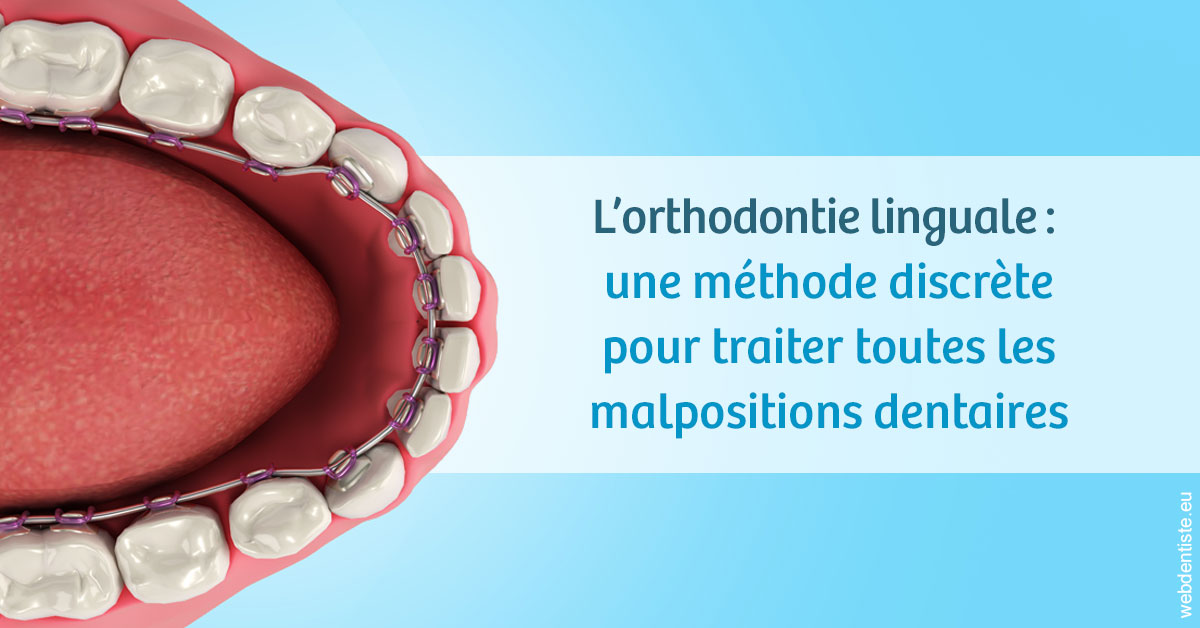 https://www.selarl-dentistes-le-canet.fr/L'orthodontie linguale 1