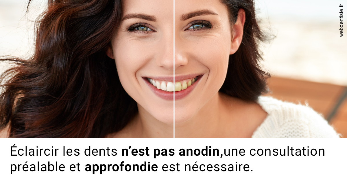 https://www.selarl-dentistes-le-canet.fr/Le blanchiment 2