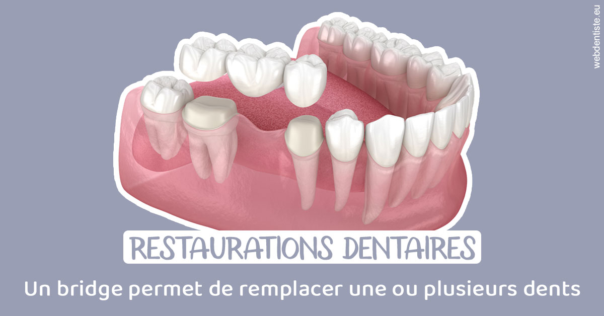 https://www.selarl-dentistes-le-canet.fr/Bridge remplacer dents 1