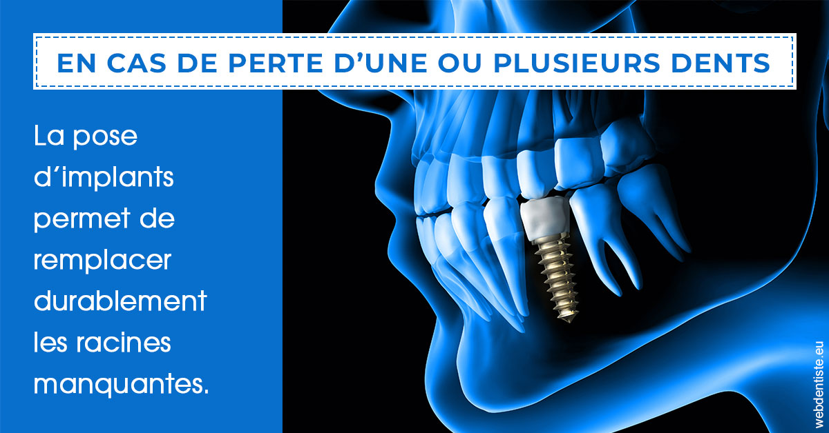 https://www.selarl-dentistes-le-canet.fr/2024 T1 - Implants 01