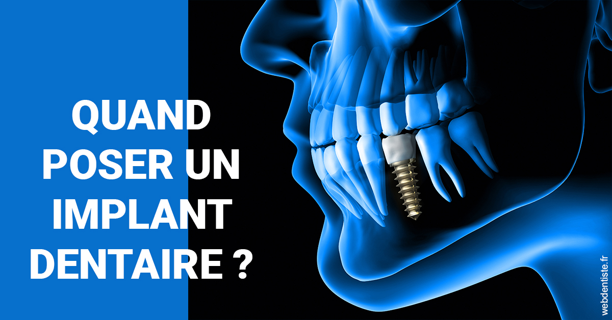 https://www.selarl-dentistes-le-canet.fr/Les implants 1