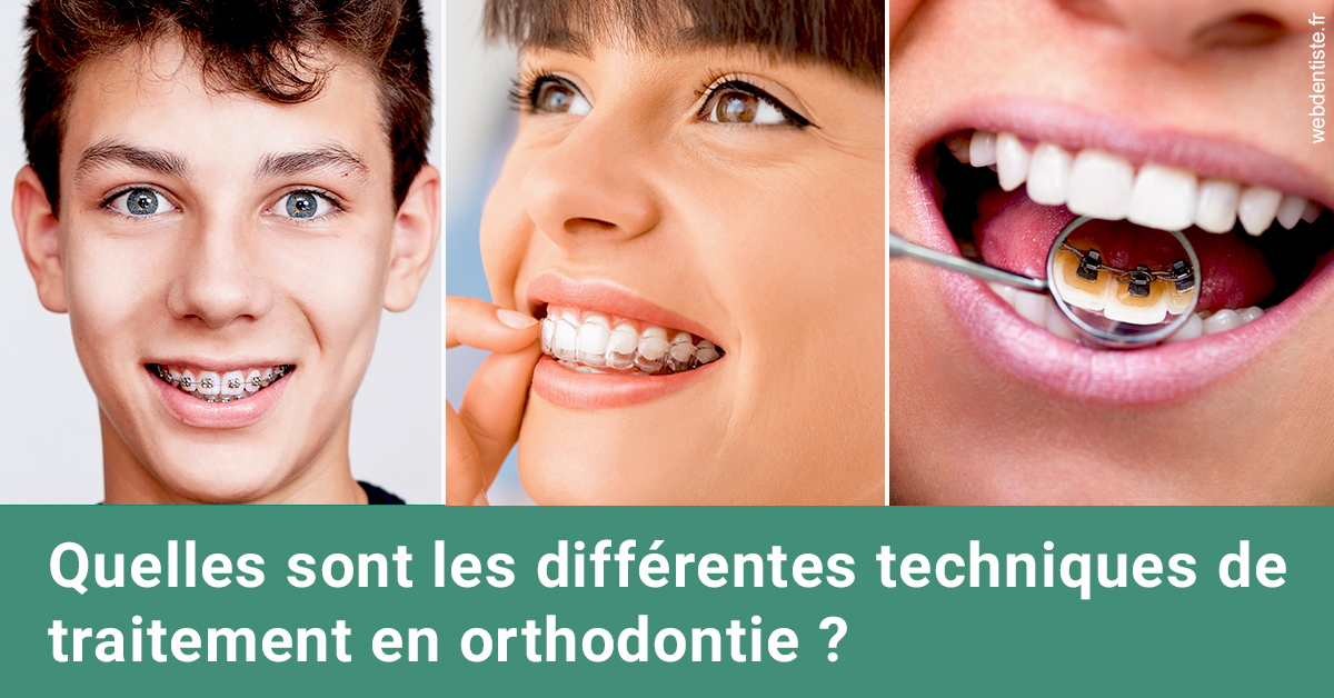 https://www.selarl-dentistes-le-canet.fr/Les différentes techniques de traitement 2