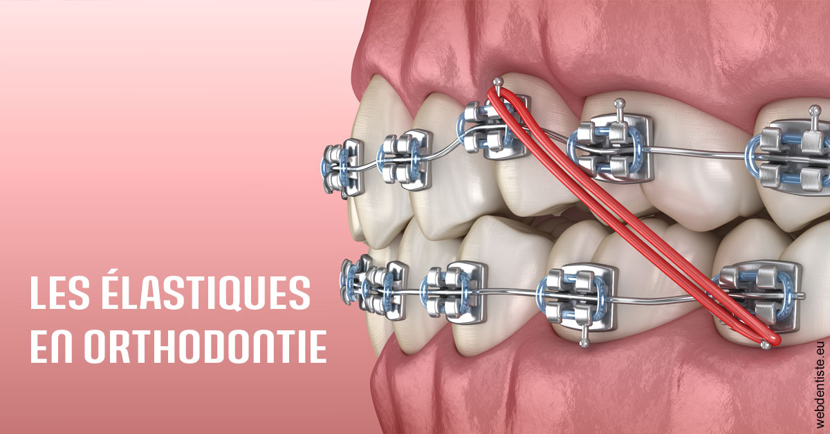 https://www.selarl-dentistes-le-canet.fr/Elastiques orthodontie 2