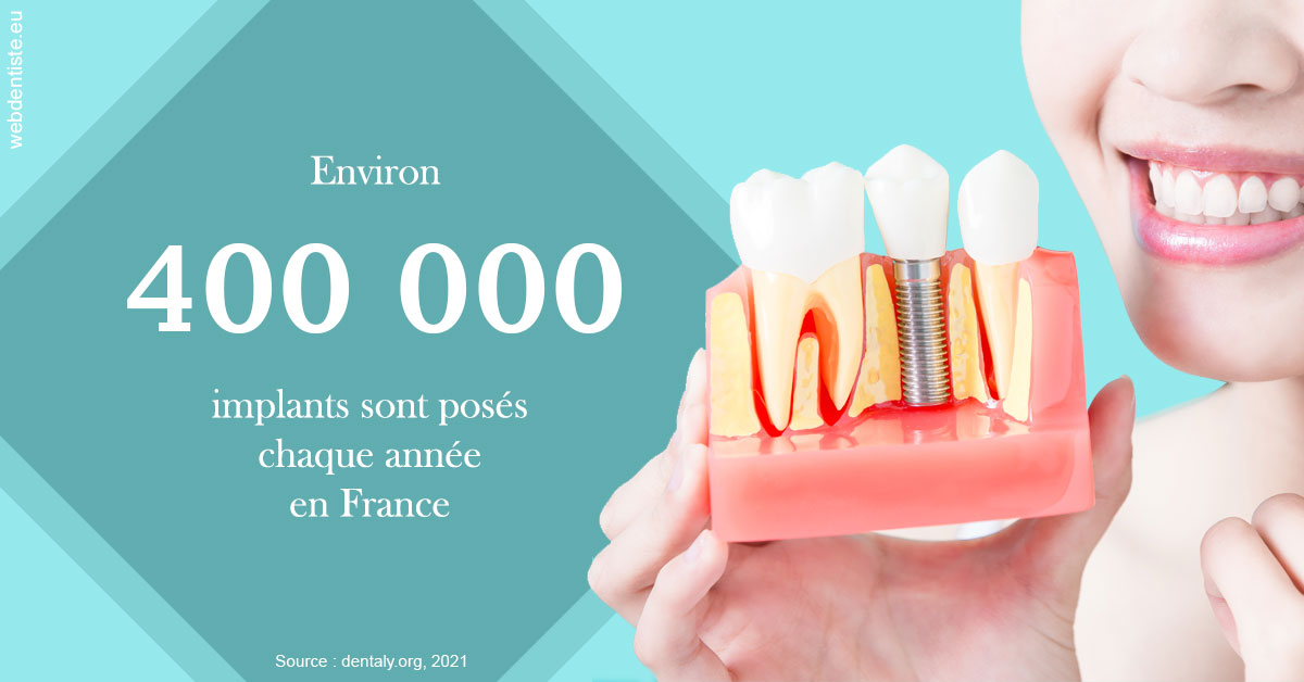 https://www.selarl-dentistes-le-canet.fr/Pose d'implants en France 2
