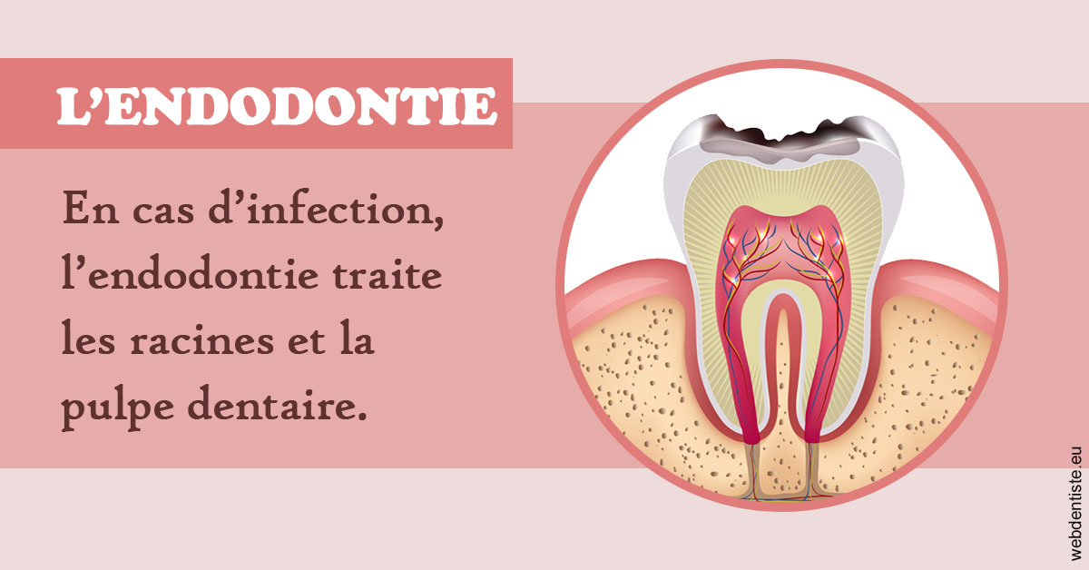 https://www.selarl-dentistes-le-canet.fr/L'endodontie 2