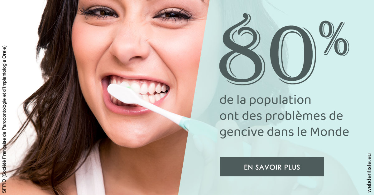 https://www.selarl-dentistes-le-canet.fr/Problèmes de gencive 1